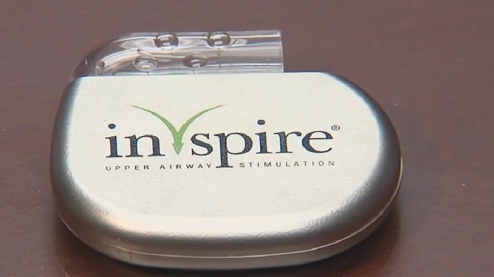 Implantable device offers relief for severe cases of sleep apnea WBMA
