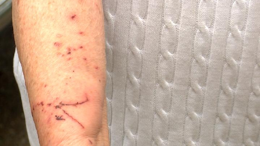 Three people each attacked by a squirrel in North Myrtle Beach WPDE